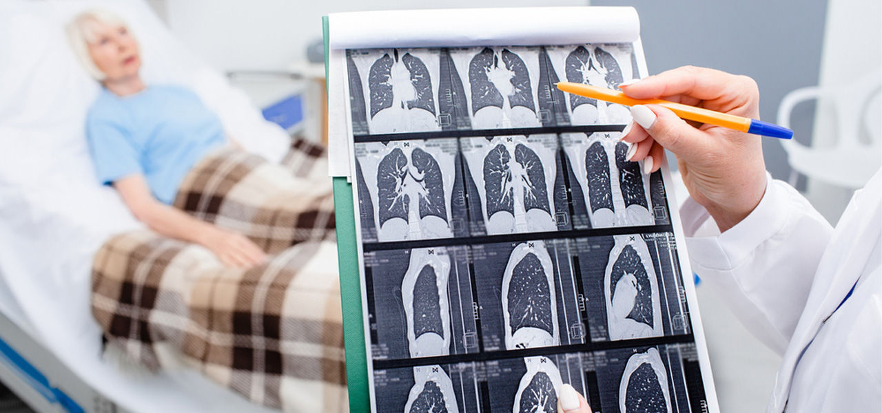 November is lung cancer awareness month lung cancer patient in bed with lung xrays in foreground